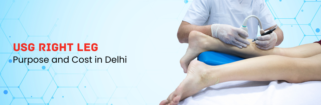 USG Right Leg: Purpose and Cost in Delhi